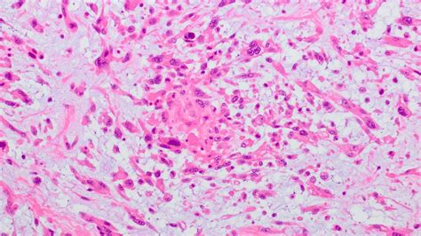 Understanding the Potential of